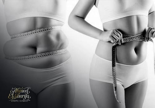 Difference between liposuction and liposculpture